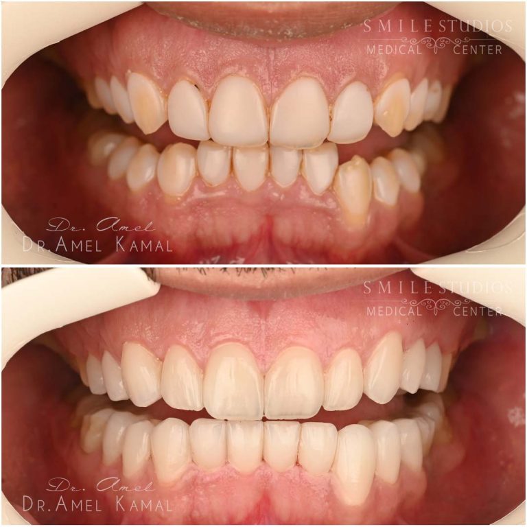 Meshal B & A 1 copy